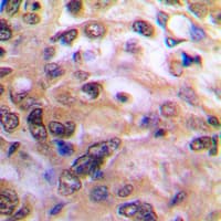 NFKB1 / NF-Kappa-B Antibody (C-Terminus)