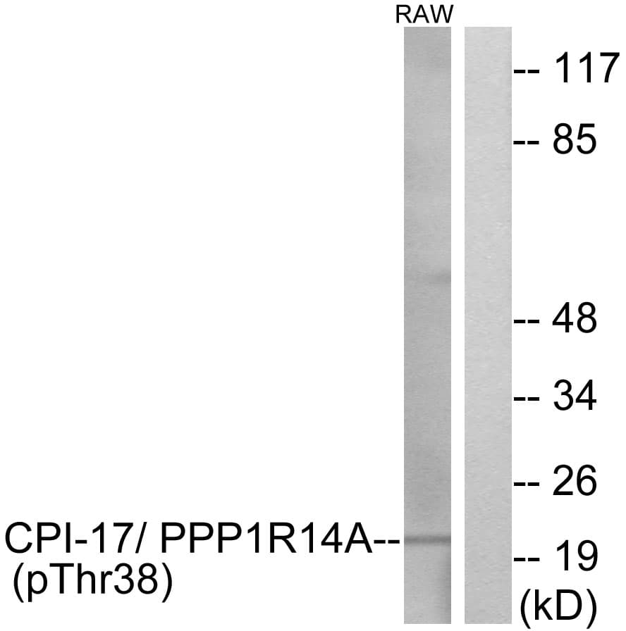 PPP1R14A / CPI-17 Antibody (phospho-Thr38)