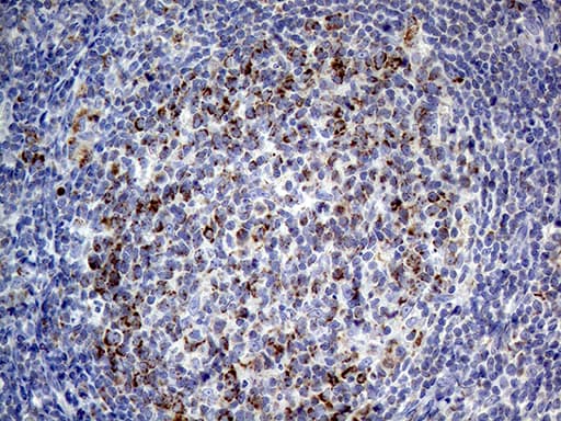 Monoclonal Mouse anti-Human MRPL15 Antibody (clone OTI10B10, aa28-296, IHC, WB)