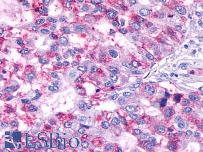 PathPlus™ Polyclonal Rabbit anti-Human LPAR6 / P2RY5 / P2Y5 Antibody (C-Terminus, IHC)