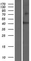 SLC35D3 / FRCL1 Protein (Over-Expression Lysate Myc-DDK (Flag))