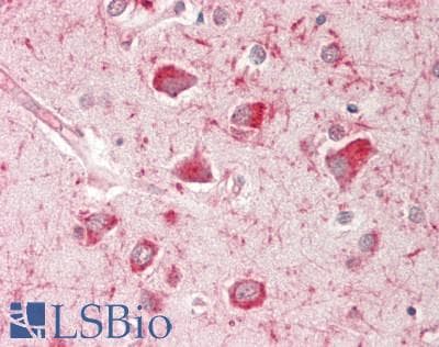 Polyclonal Rabbit anti-Human PLP1 / Myelin PLP Antibody (aa72-121, IHC, WB)