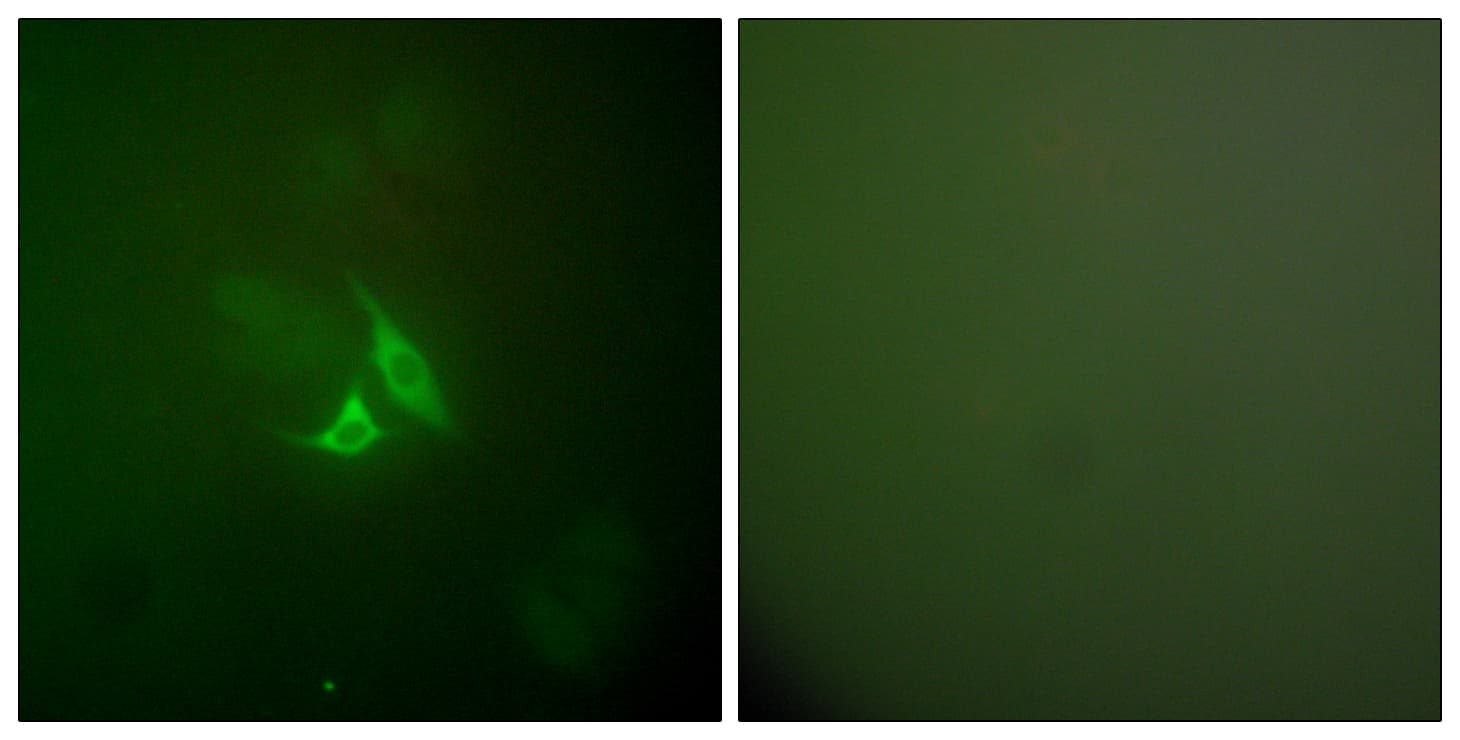 PTGS2 / COX2 / COX-2 Antibody (aa555-604)