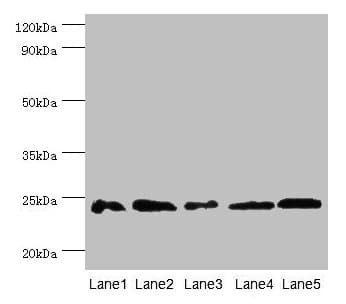 Polyclonal Rabbit anti-Mouse GSTP1 / GST Pi Antibody (aa2-210, WB)