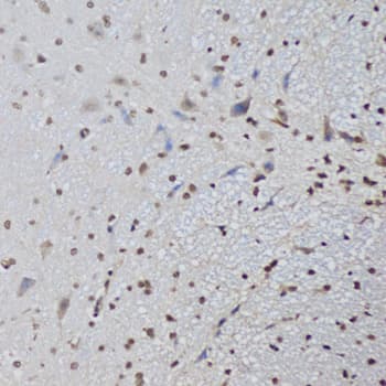 CTCF Antibody