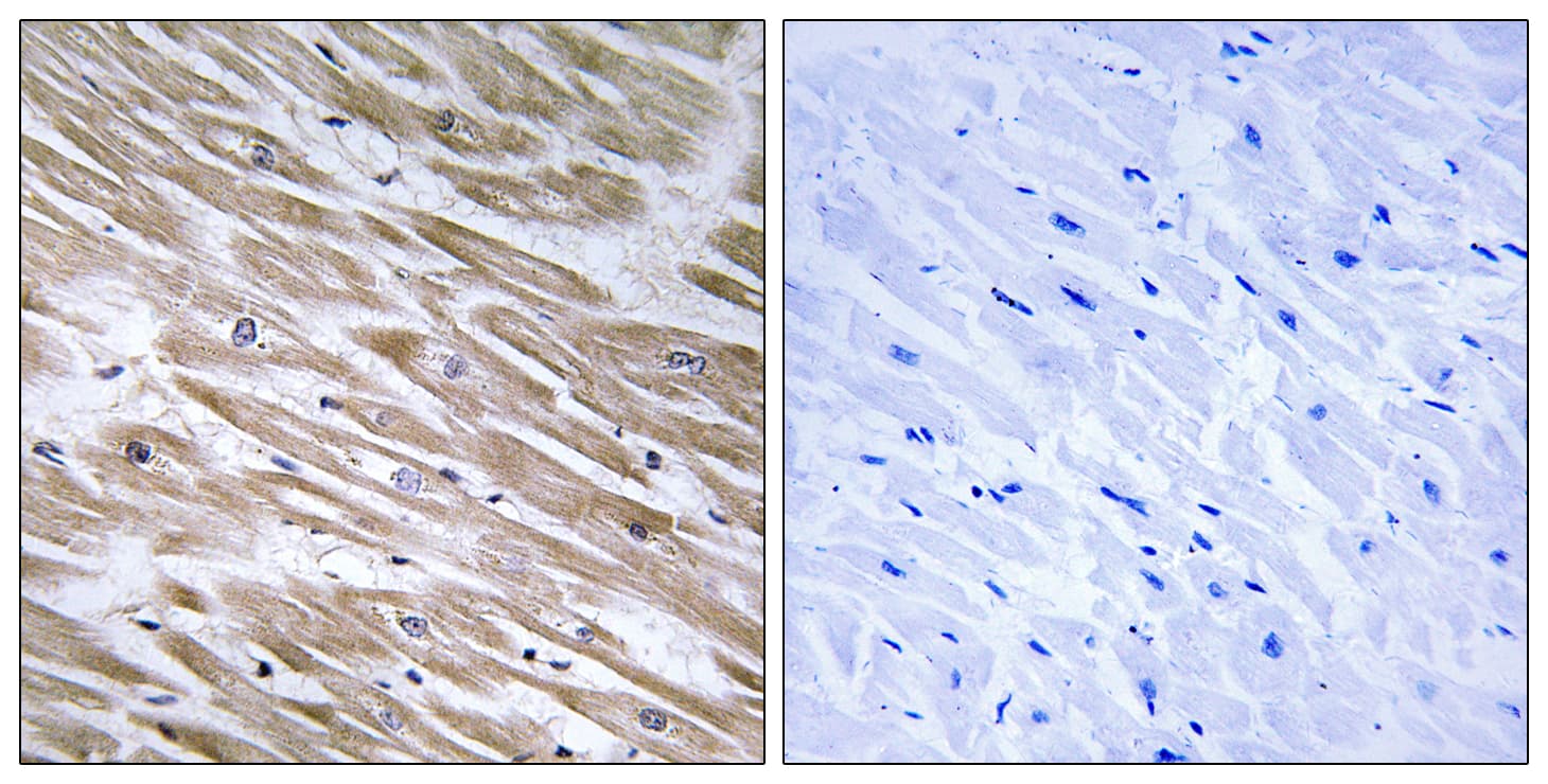 Polyclonal Rabbit anti-Human KANK2 Antibody (aa351-400, IHC, IF)