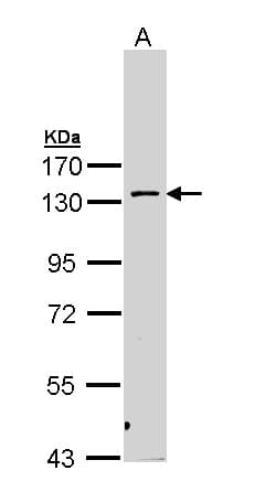 PKN2 Antibody (aa46-366)