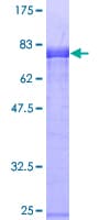 Human AFAP1 / AFAP Protein (Recombinant GST)