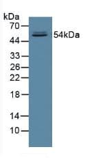 Alpha Fucosidase / FUCA1 Antibody (aa53-289, PE)