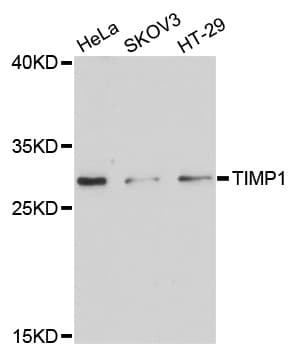 TIMP1 Antibody