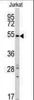 SMYD5 Antibody (aa341-371)