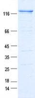 Human USP28 Protein (Recombinant DDK,C-terminus)