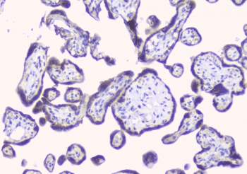 ERGIC-53 / LMAN1 Antibody