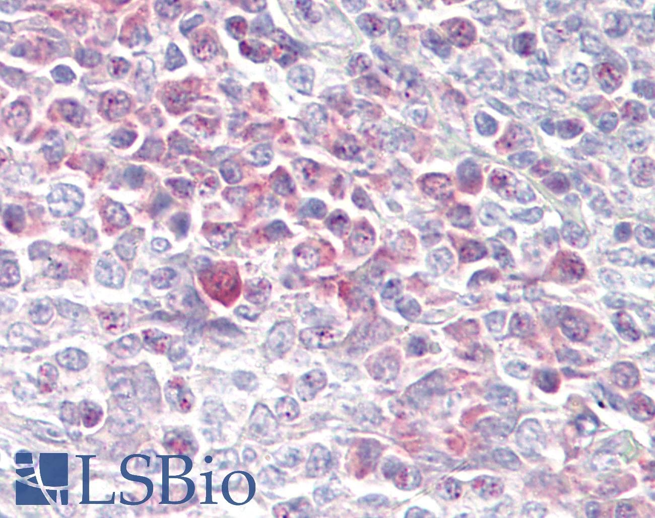 IHC-plus™ USP7 / HAUSP Antibody (aa1050-1100)