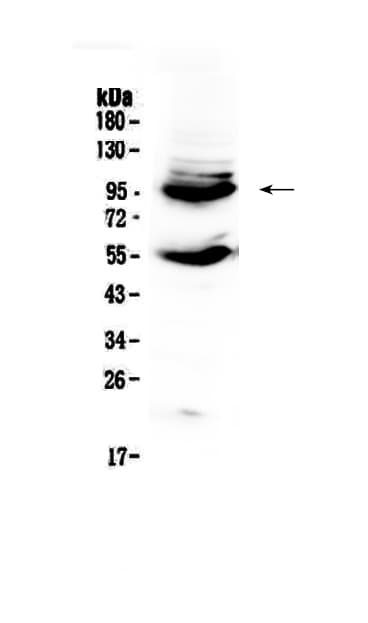 CD105 Antibody
