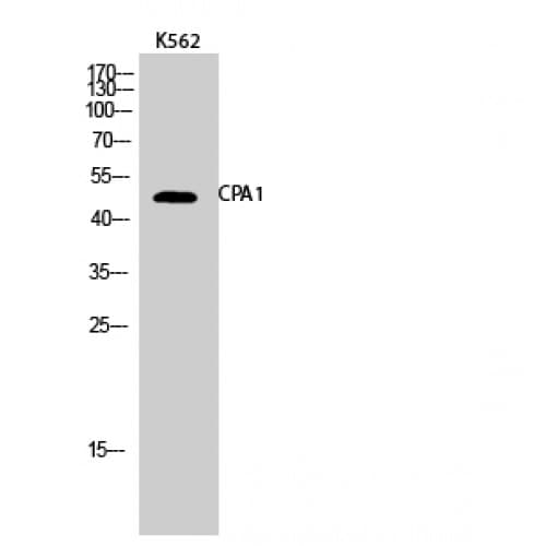 CPA1 / Carboxypeptidase A Antibody (270-350 aa, Internal)