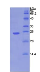 Human NPEPPS Protein (Recombinant His)