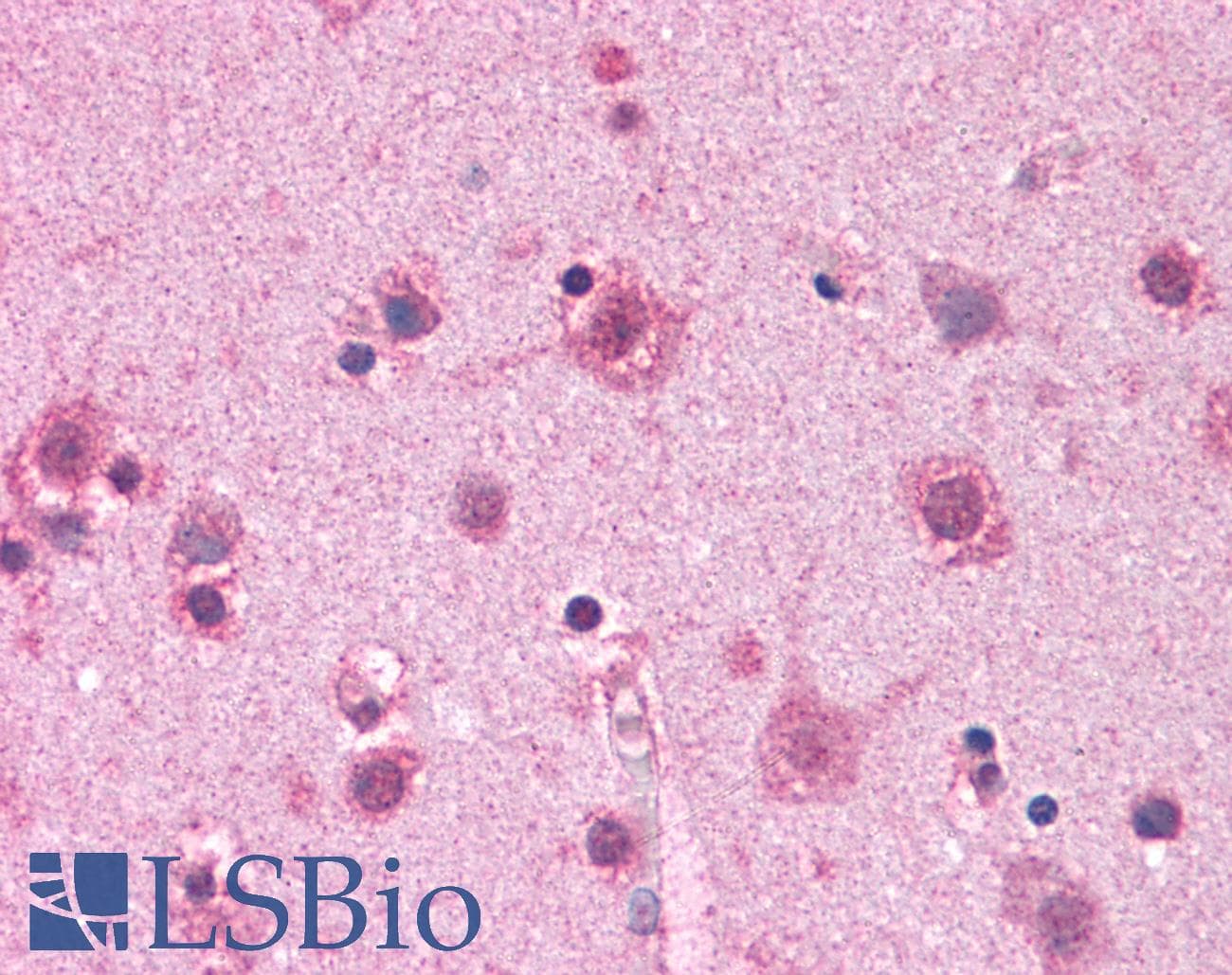 IHC-plus™ Polyclonal Rabbit anti-Human CADPS Antibody (IHC, IF, WB)
