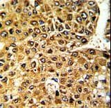 Polyclonal Rabbit anti-Human MLX / TCFL4 Antibody (aa125-151, IHC, WB)