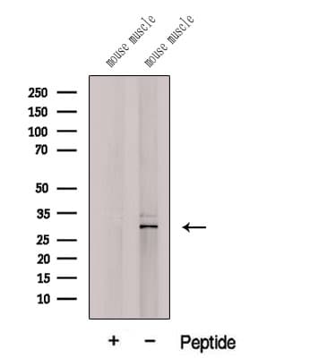 Polyclonal Rabbit anti-Human C19orf52 Antibody (IF, WB)