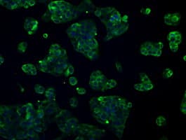 Monoclonal Mouse anti-Human L1CAM Antibody (clone OTI2C7, IHC, IF, WB)