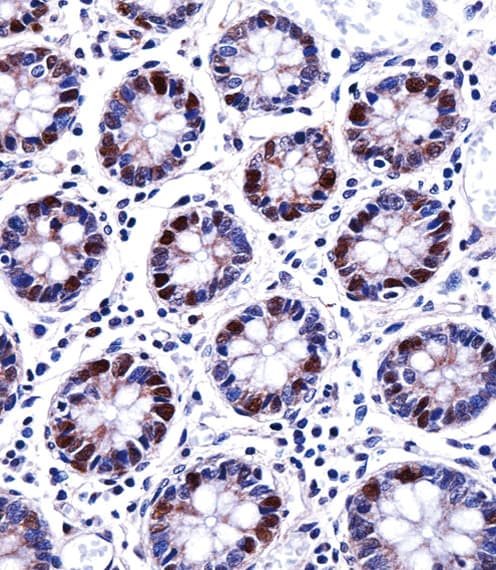 DUT / DUTPase Antibody (aa170-198)