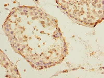 STAR Antibody