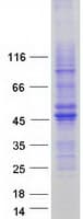 Human C11orf42 Protein (Recombinant Myc-DDK (Flag))