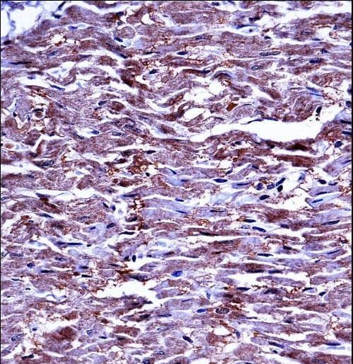 MMP15 Antibody (aa168-196)