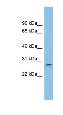 Polyclonal Rabbit anti-Human RUSC1-AS1 / C1orf104 Antibody (aa143-192, WB)
