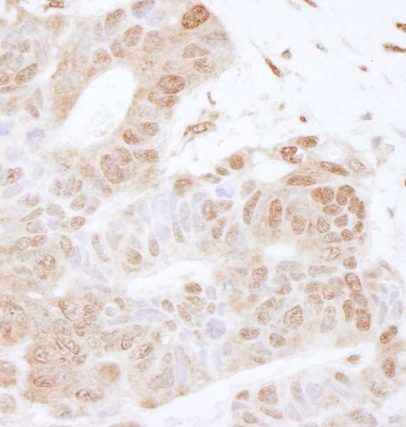 FOXK2 / ILF Antibody (aa600-635)
