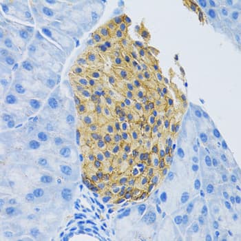 SLC1A2 / EAAT2 / GLT-1 Antibody (aa495-574)