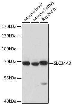Polyclonal Rabbit anti-Human SLC34A3 / NaPi-2c Antibody (WB)