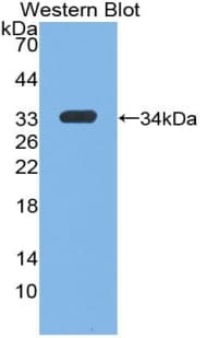 IGF1 Antibody (aa49-118)