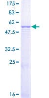 Human MMS19 Protein (Recombinant GST)