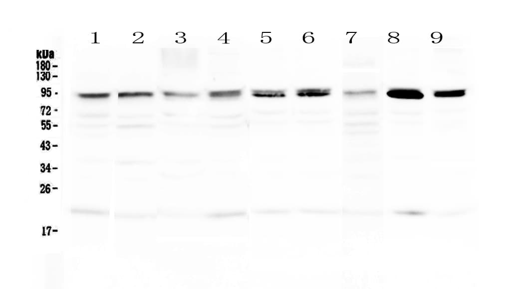 BLIMP1 / PRDM1 Antibody