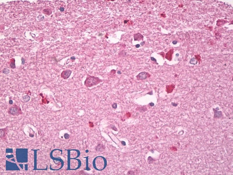 RHOG / ARHG Antibody (aa112-161)