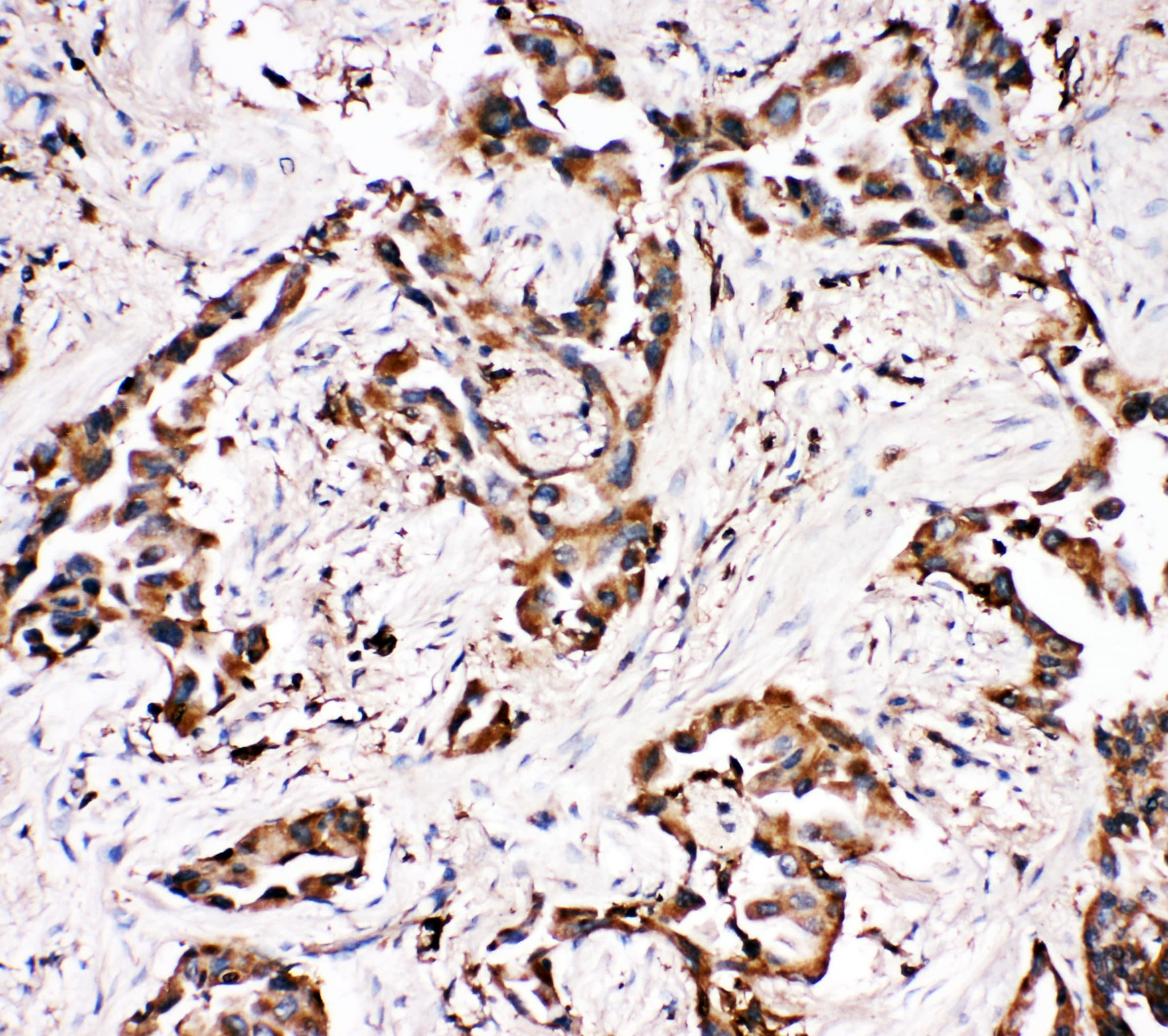 APLP1 / APLP-1 Antibody (aa101-120)
