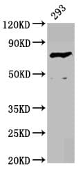 Polyclonal Rabbit anti-Human F13B / TGase Antibody (WB)