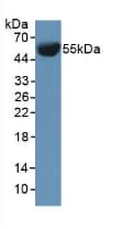IVL / Involucrin Antibody (aa301-460)
