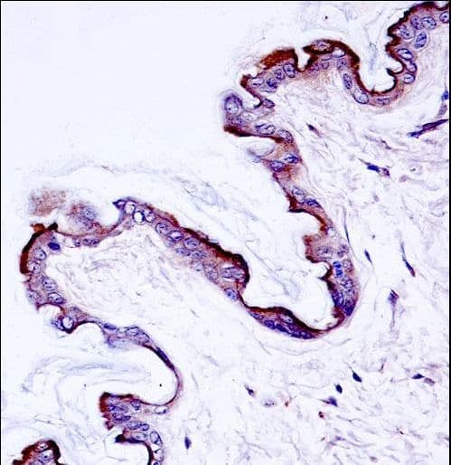 PRKCH / PKC-Eta Antibody (aa314-341)