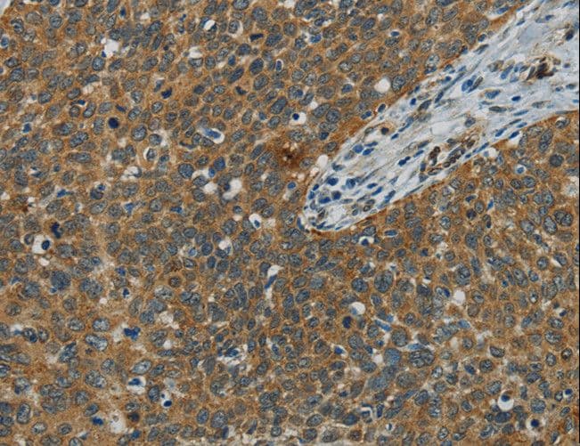 E2F6 Antibody