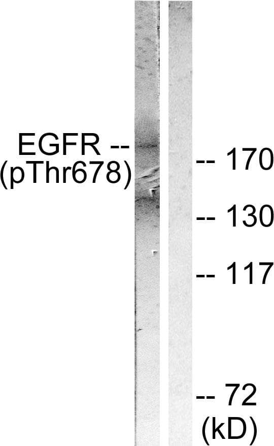 EGFR Antibody (phospho-Thr678)