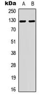 Polyclonal Rabbit anti-Human TNS2 / TENC1 Antibody (Internal, WB)