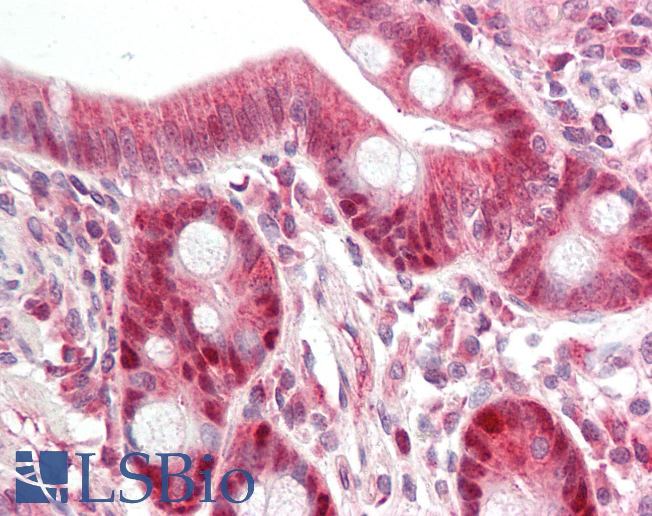 IHC-plus™ SGSM3 Antibody