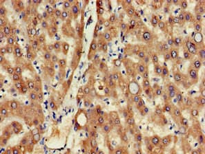 SEPX1 / Selenoprotein R Antibody