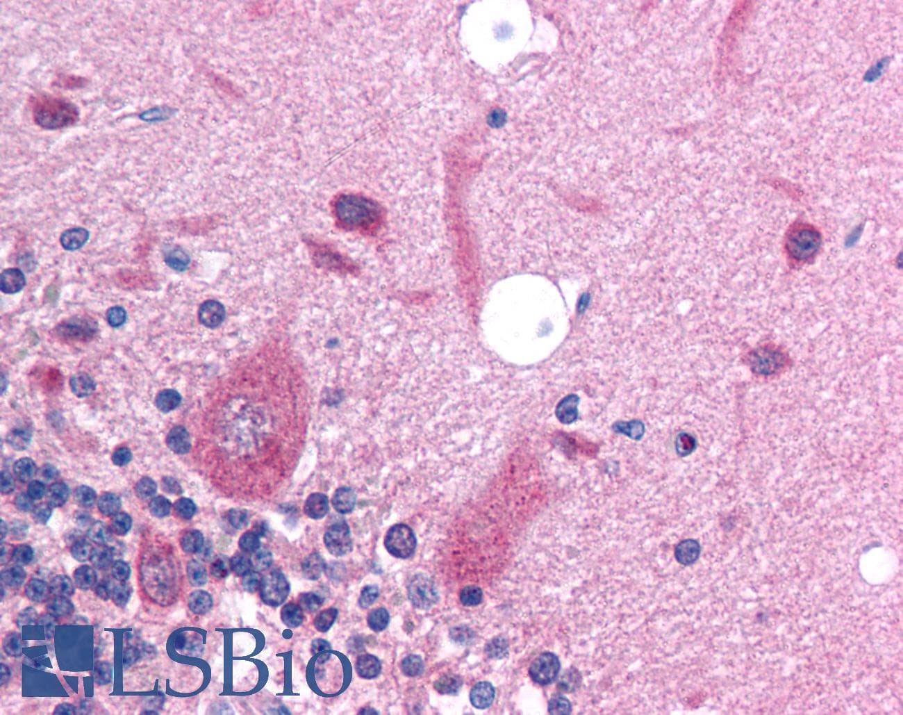 Polyclonal Rabbit anti-Human SLC17A2 Antibody (aa230-279, IHC, WB)