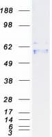 Human P2RX2 / P2X2 Protein (Recombinant Myc-DDK (Flag))