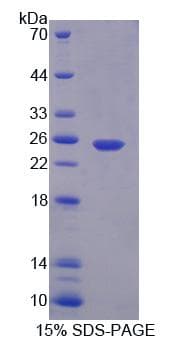Human CAPN7 / Calpain 7 Protein (Recombinant His, N-Terminal)