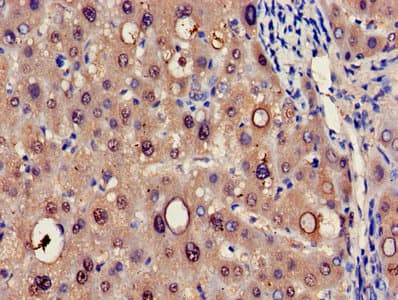 Polyclonal Rabbit anti-Human HRSP12 / UK114 Antibody